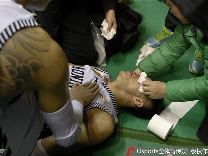 赛场惊魂：郭艾伦遭水瓶袭击血洒本溪，文明底线何在