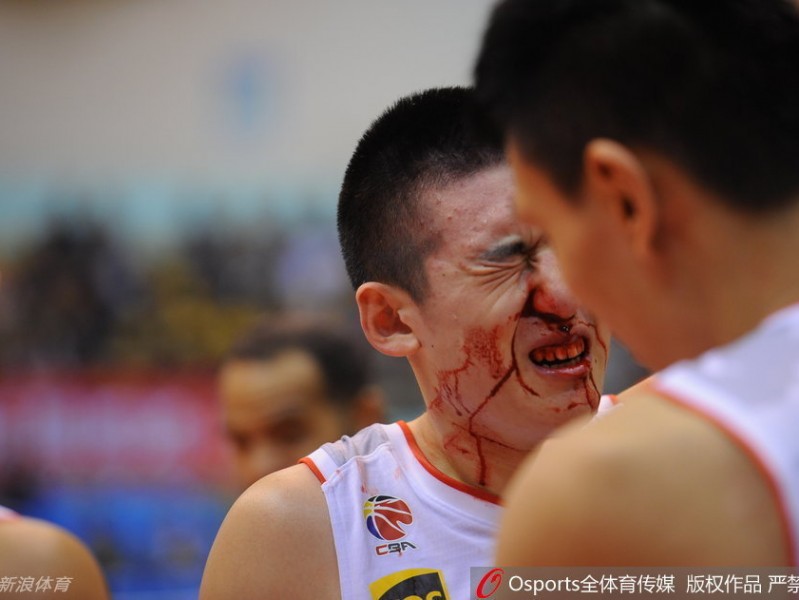 铁军新星血染赛场：菜鸟付豪鼻梁骨折依旧笑对，诠释八一篮球不屈之魂